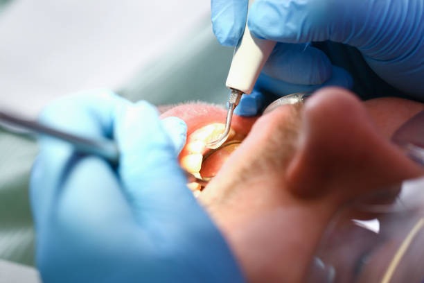 Best Emergency Gum Treatment in Canyon Lake, TX