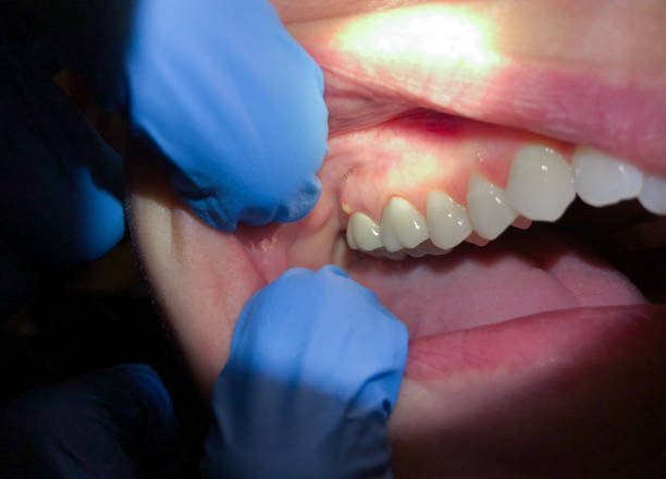 Best Urgent Care for Lost Fillings or Crowns in Canyon Lake, TX