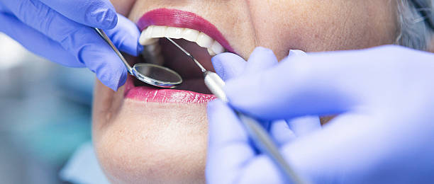 Best Emergency Treatment for Dental Infections or Abscesses in Canyon Lake, TX
